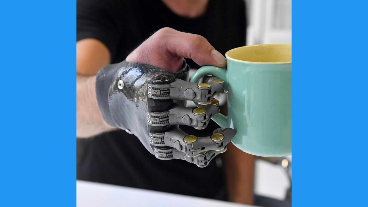 Breakthrough prosthetic fingers revolutionize the lives of amputees -  CyberGuy