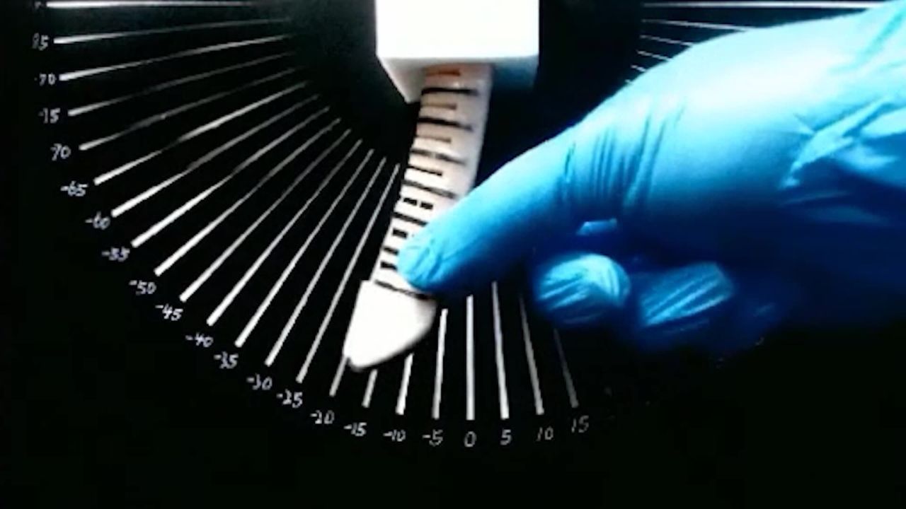 Image of robotic finger 