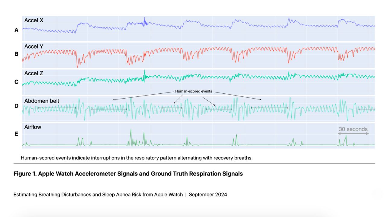 Sleep Apnea data from the Apple Watch 