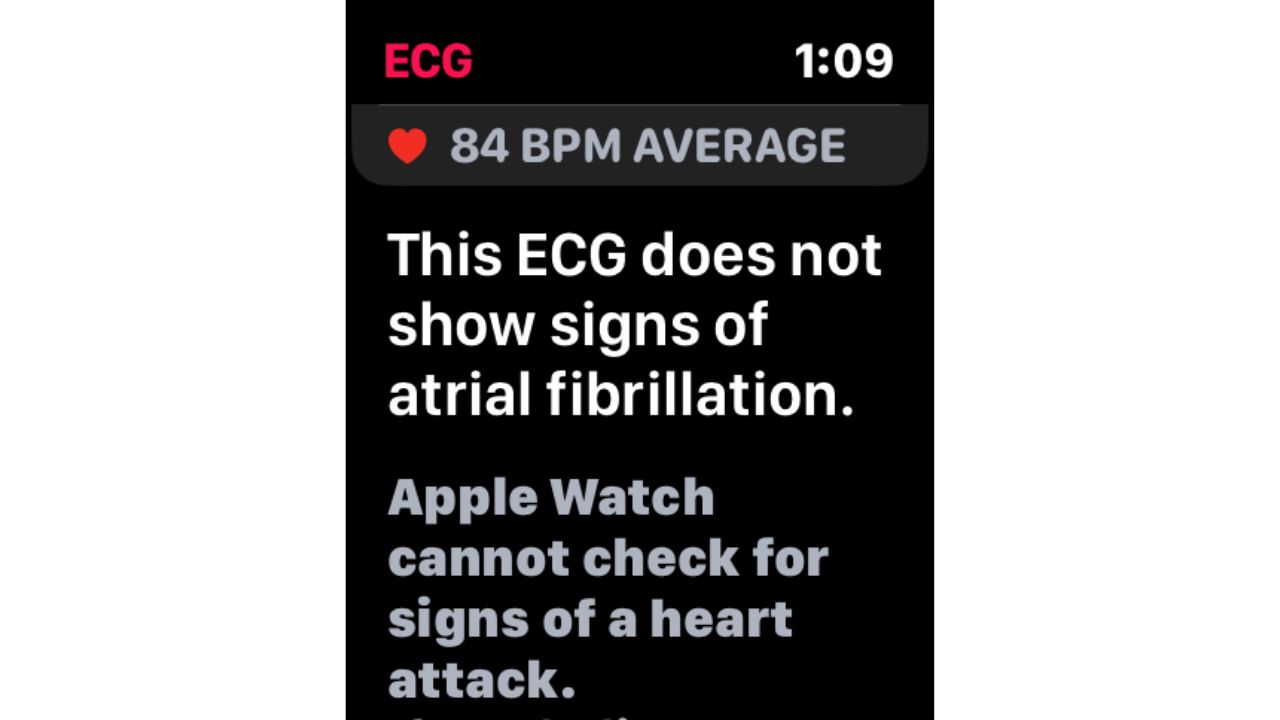 Steps to take ECG on Apple Watch