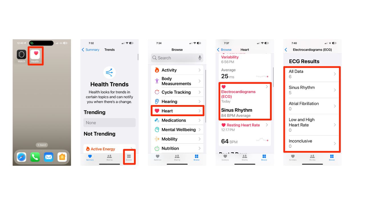 Viewing your ECG history and adding symptoms