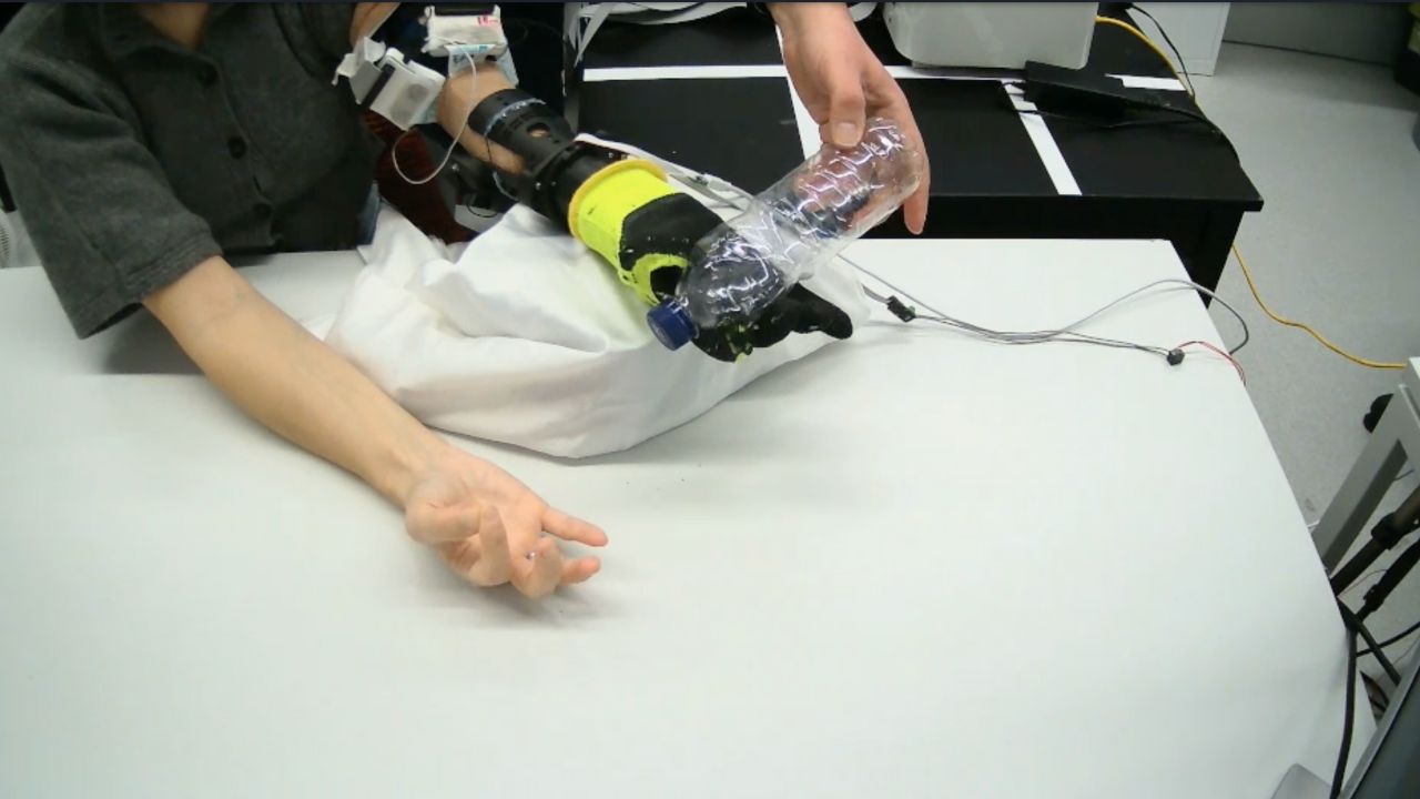 A new soft prosthetic hand designed for more intuitive control