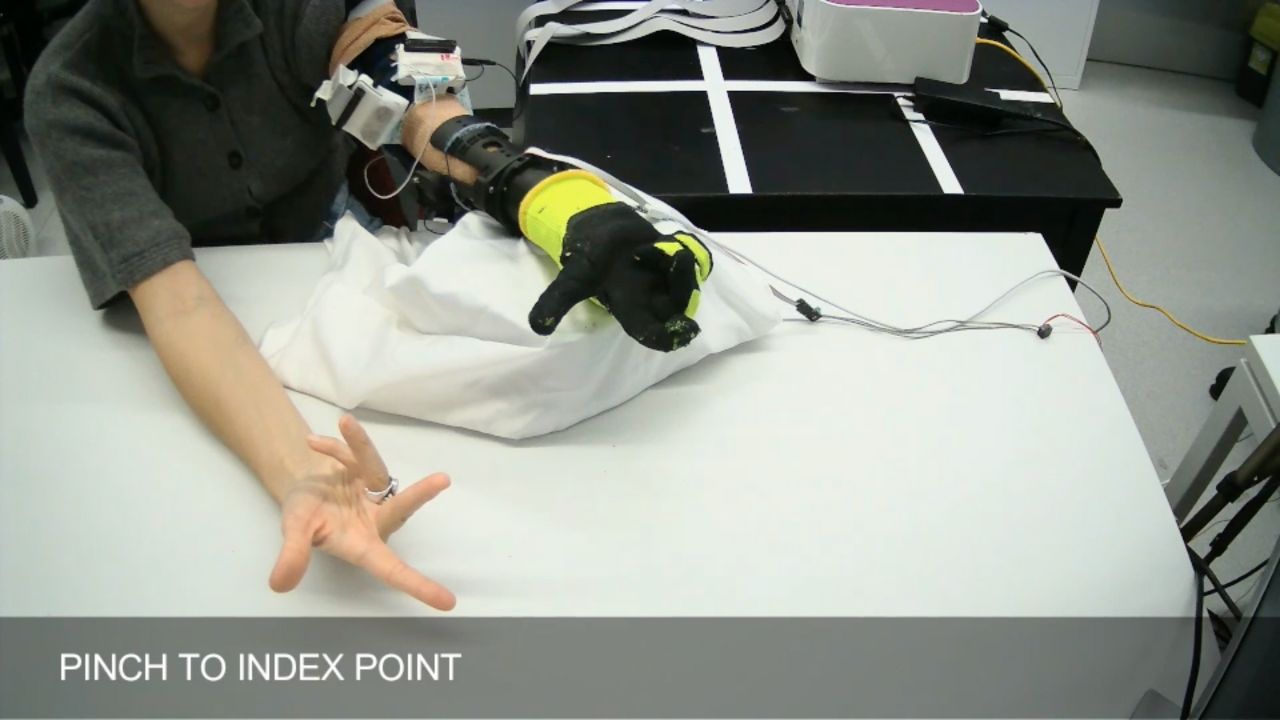 A new soft prosthetic hand designed for more intuitive control